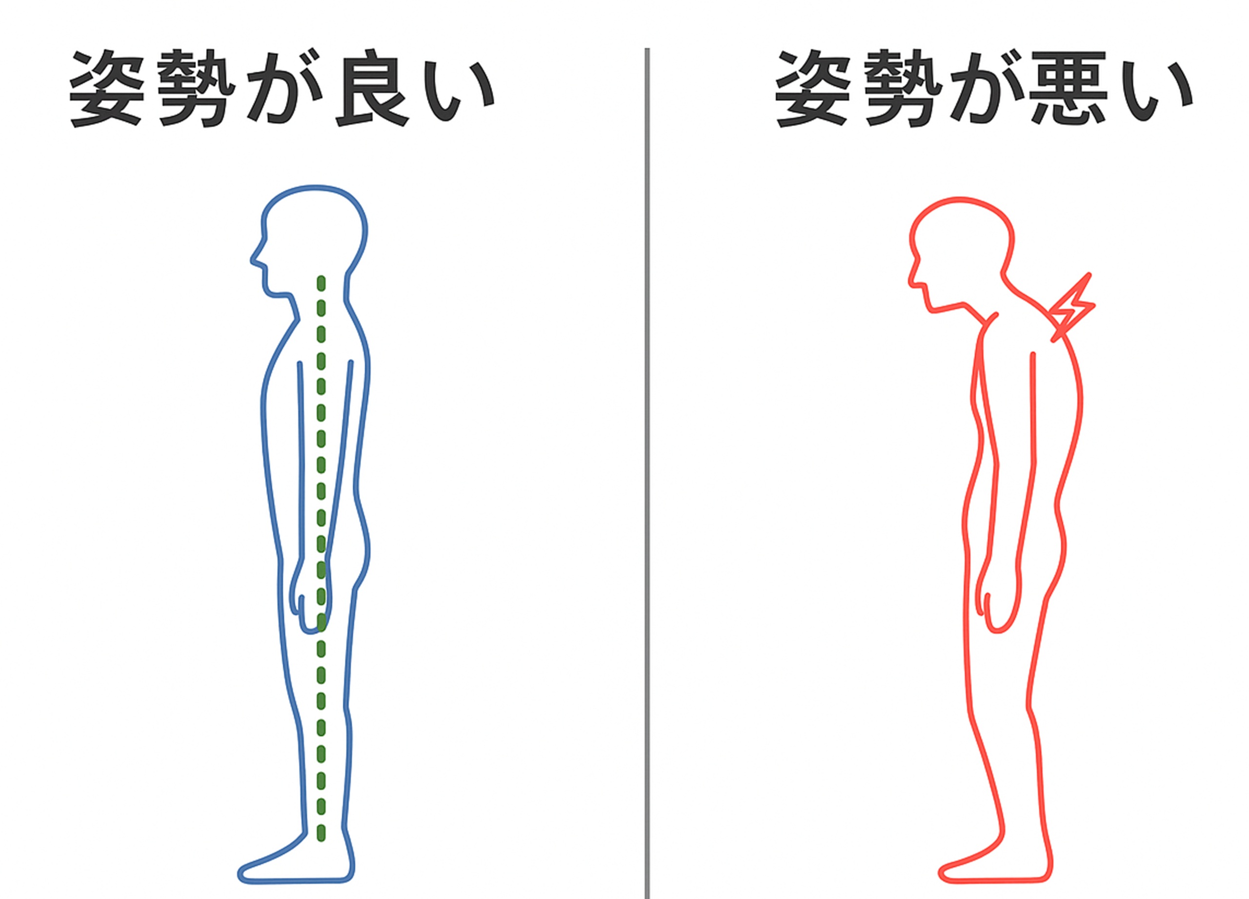 姿勢が良い状態と悪い状態の比較